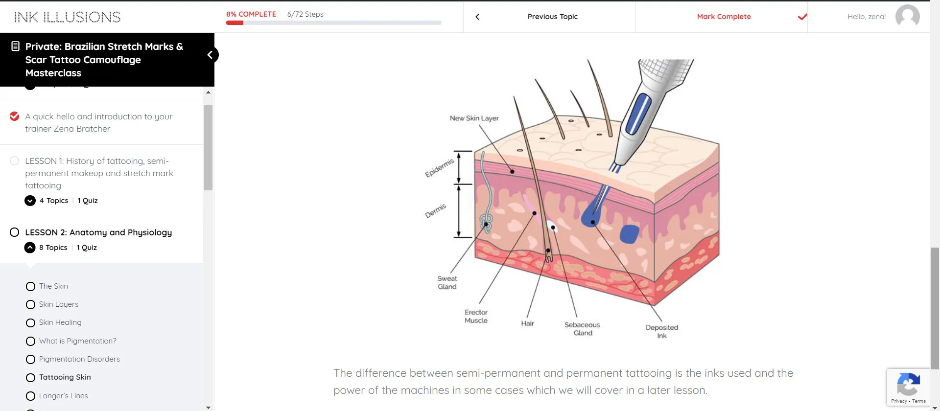Scar & Stretch Mark micropigmentation
