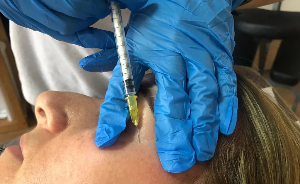 Basic Anti-wrinkle Injections