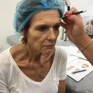 Basic Anti-wrinkle Injections
