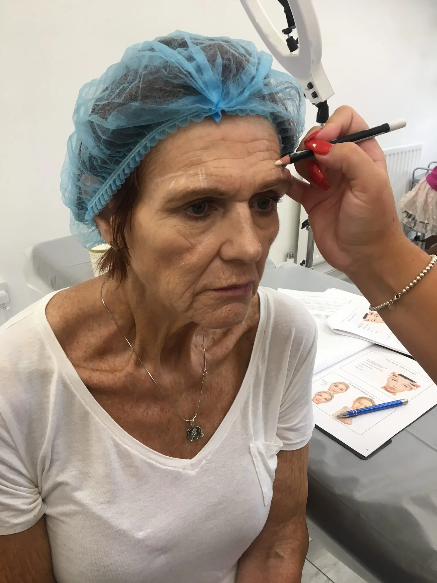 Basic Anti-wrinkle Injections