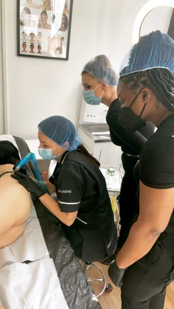 Scar & Stretch Mark micropigmentation