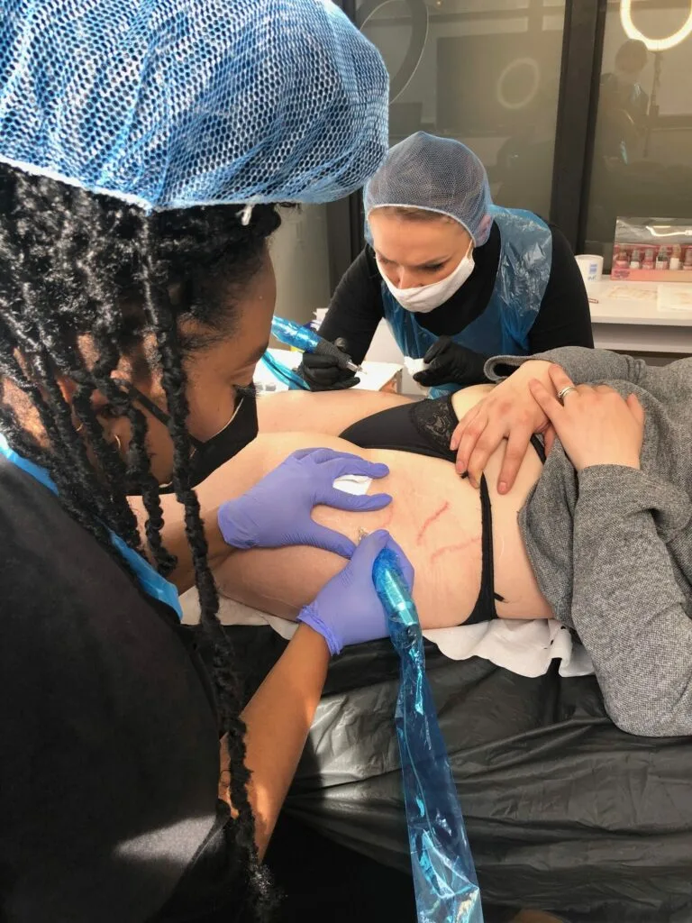 students working on a model treating stretch marks