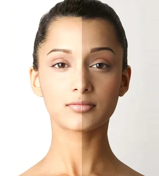 melanin white black